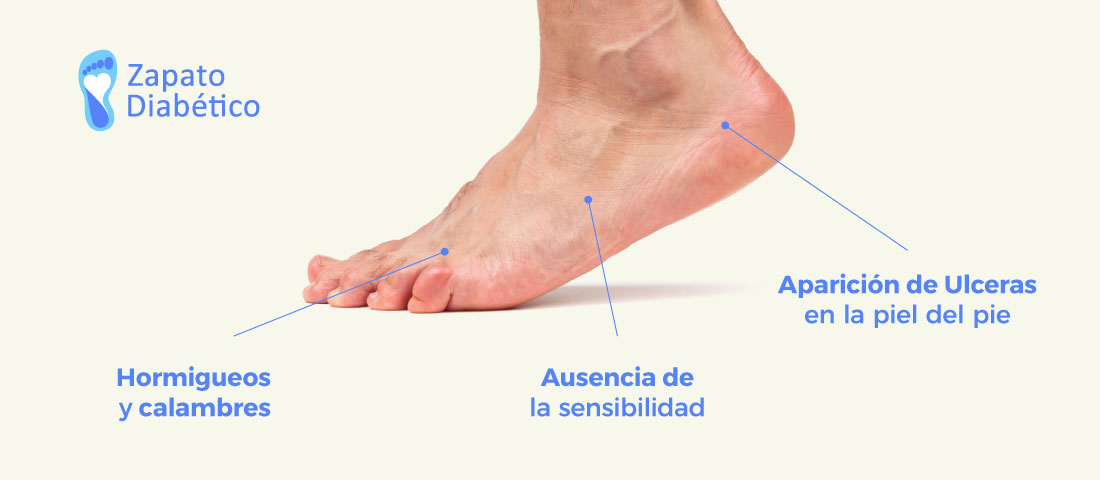 pie diabetico