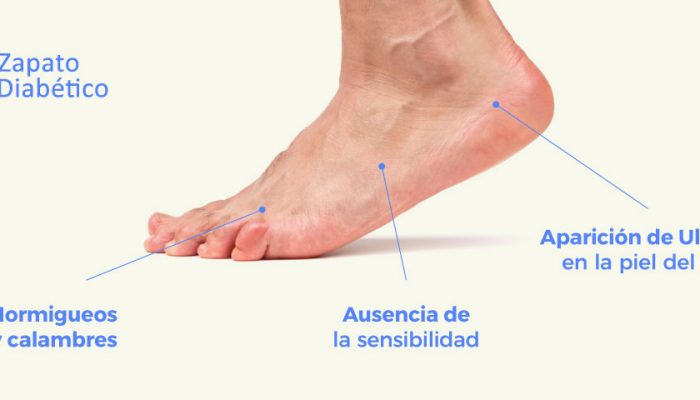 pie diabetico