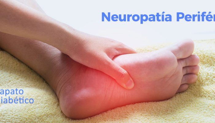 neuropatía periférica